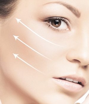 How is Facelift Surgery Performed?