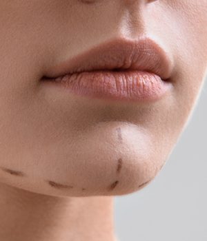 Are There Any Risks of Jaw Surgery?