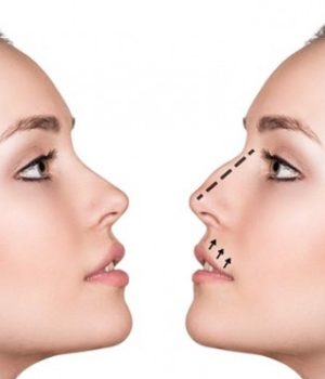 What are the Differences Between Primary Rhinoplasty and Revision Nose Surgery?