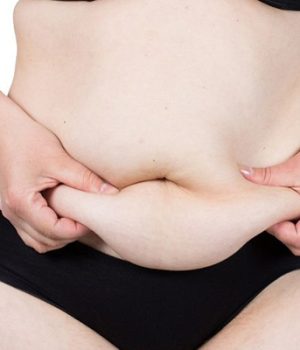 Post Bariatric Surgery Cost Turkey – Skin After Weight Loss Surgery in Istanbul