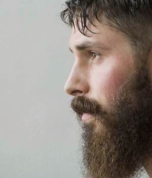 What Should Be Considered After Beard Transplantation?