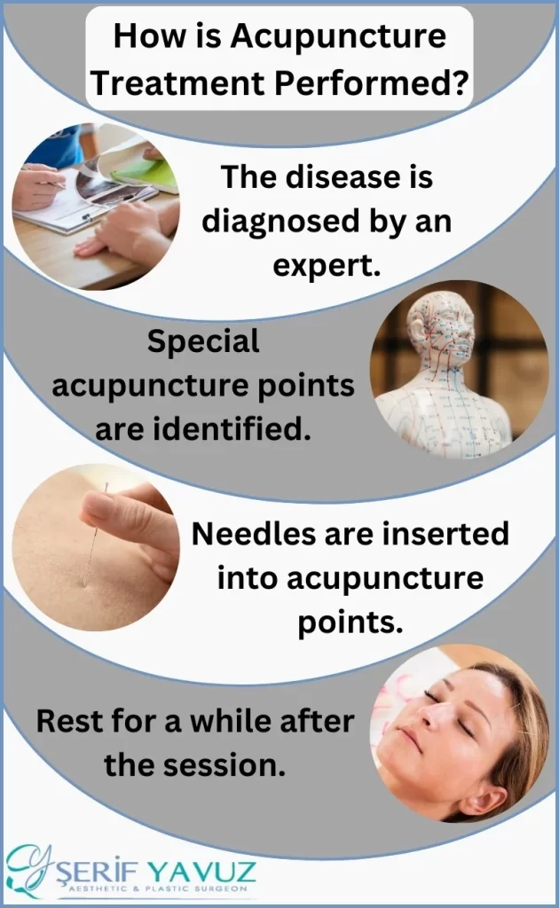how acupuncture treatment is performed
