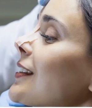 How long does it take for stitches to go away after rhinoplasty? Will scar disappear after surgery?