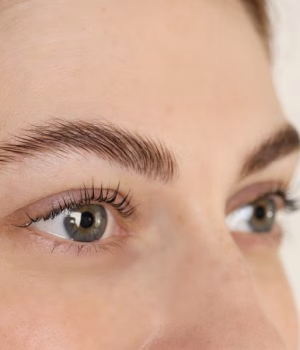 Understanding the Temporal Lift Approach in Turkey, Istanbul