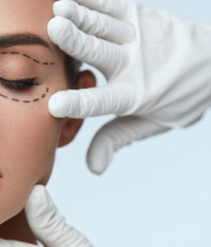 Göz Kapağı Estetiği Ameliyat Sonrası Süreci